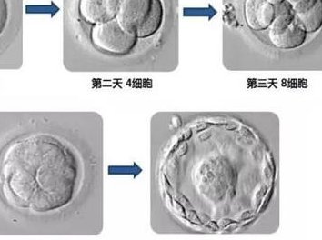 结膜炎不孕不育（结膜炎不孕不育怎么治疗）